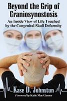 Saint Joseph CHS alumnus to speak on his book about the experience of craniosynostosis 