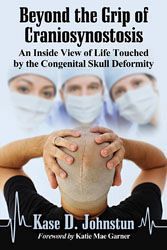 Saint Joseph CHS alumnus to speak on his book about the experience of craniosynostosis 